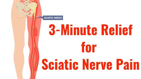 Unlocking Relief: What Are The Dos And Donts For Sciatic Nerve Pain