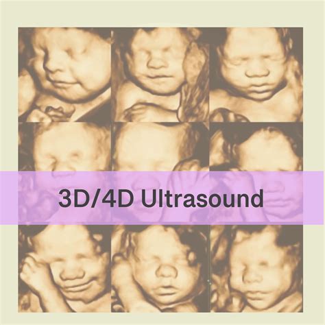 3d Ultrasound