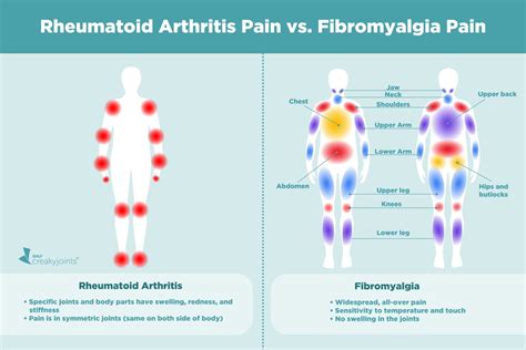 Causes of Rheumatoid Arthritis Pain Aside from Inflammation