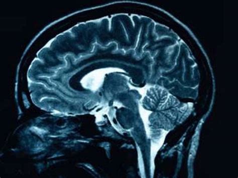 Brain MRI Scan | Tesla MRI Machine | Echelon Health