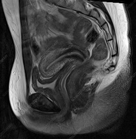 Normal female pelvis, MRI - Stock Image - C039/3847 - Science Photo Library