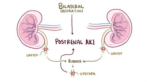 Postrenal azotemia: Video, Anatomy & Definition | Osmosis