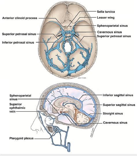 Schematic drawings of the dural venous sinuses of the skull base noting ...