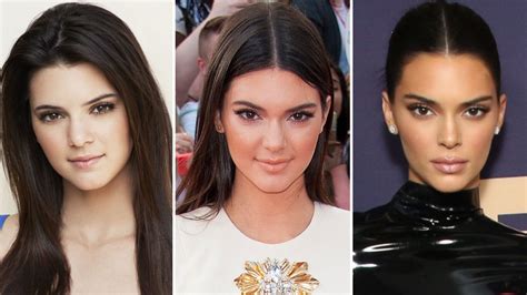 Has Kendall Jenner Had Plastic Surgery? Evertyhing She's Said