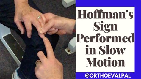 Hoffman's Sign Performed in Slow Motion - YouTube