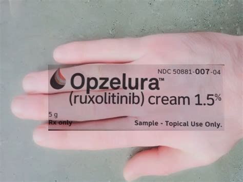 Opzelura For Vitiligo: Before And After Pics & Reviews - Dibesity