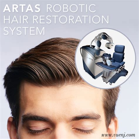 ARTAS Robotic Hair Restoration System - VUE magazine