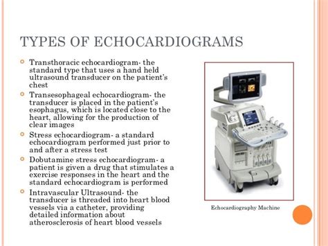 Cardiovascular diagnostic procedures