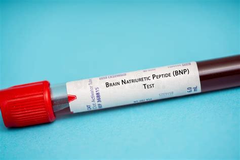 Brain Natriuretic Peptide (BNP) Test Stock Image - Image of peptide ...