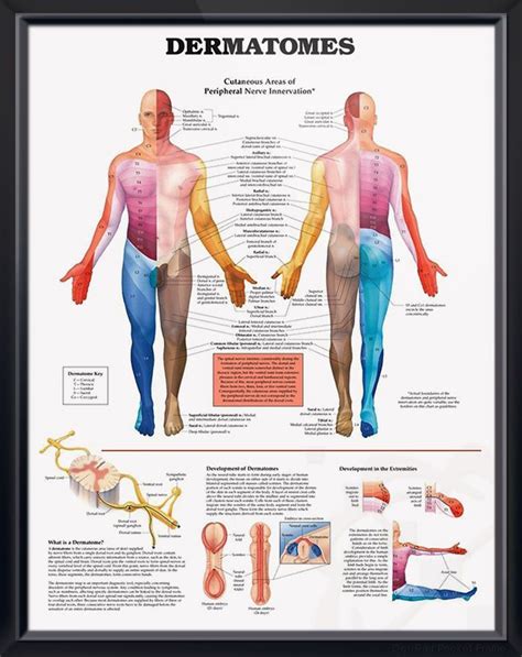 Dermatomes anatomy poster for medical office and classroom | Dermatomes ...