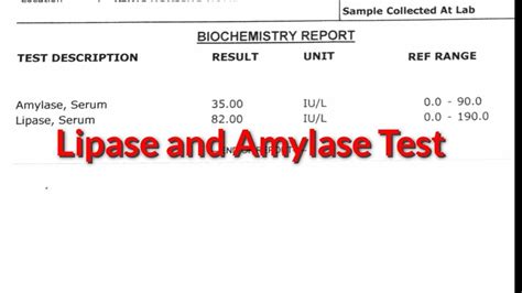 Lipase Blood Test 43 Shop Outlet | gbu-hamovniki.ru