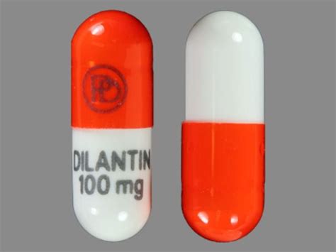 Dilantin Risk: Cerebellar Atrophy and Other Serious Side Effects