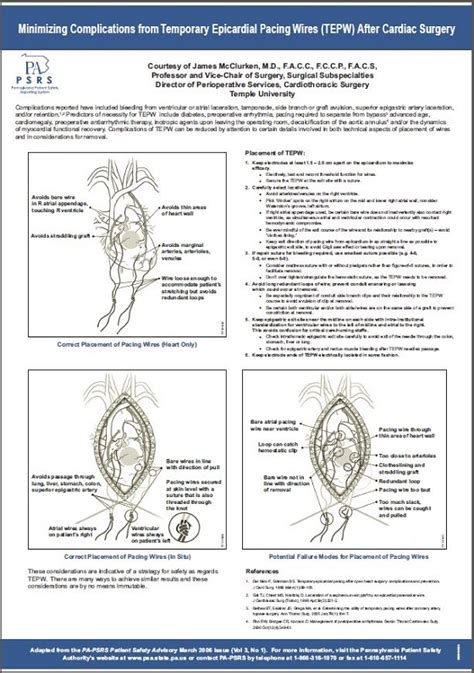 Minimizing Complications from Temporary Epicardial Pacing Wires (TEPW ...