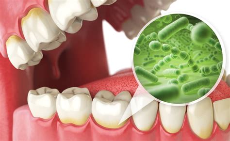 How Oral Bacteria Can Affect the Rest of Your Body