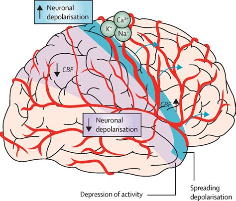 Migraine pathophysiology: lessons from mouse models and human genetics ...