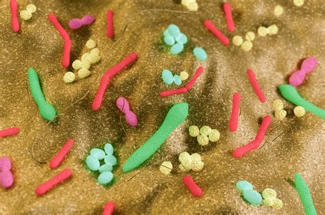 Bifidobacterium | A Beginner’s Guide (UPDATE: Jun 2018) | 8 Things You Need to Know