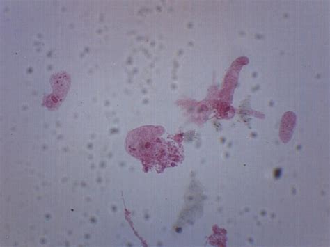 Amoeba Proteus, Whole Mount - Prepared Microscope Slide - Edulab