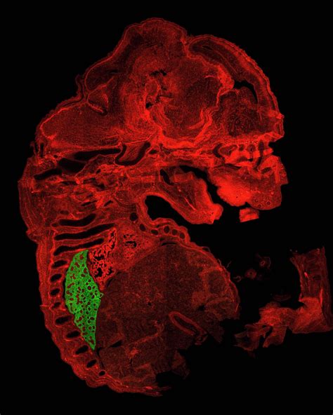 Transgenic Mouse Model [IMAGE] | EurekAlert! Science News Releases