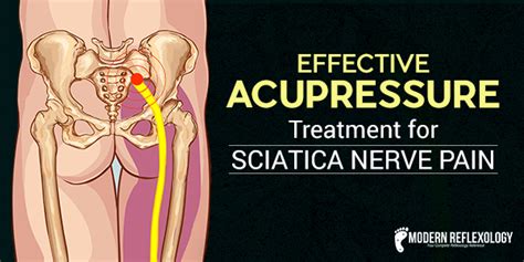 4 Simple Acupressure Points to Treat Sciatica Nerve Pain at Home