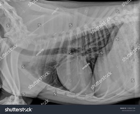 Normal Lateral Thoracic Chest Xray Radiograph: ภาพประกอบสต็อก 1338067748 | Shutterstock