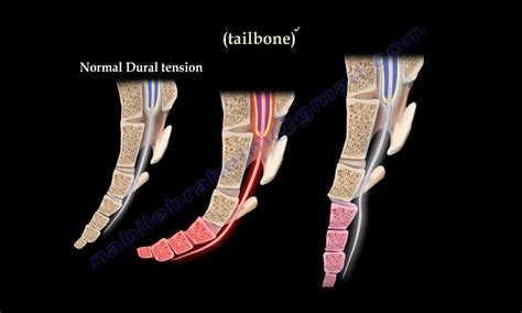 Coccydynia — OrthopaedicPrinciples.com