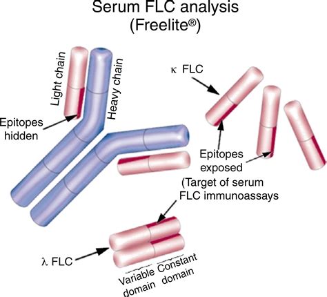 SciELO - Brasil - Serum free light chain assays not total light chain ...