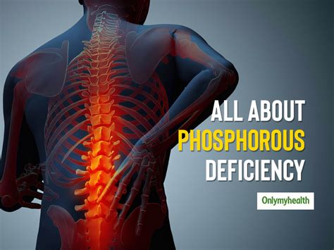 Phosphorus Deficiency: Know The Causes, Symptoms and Health Problems | OnlyMyHealth