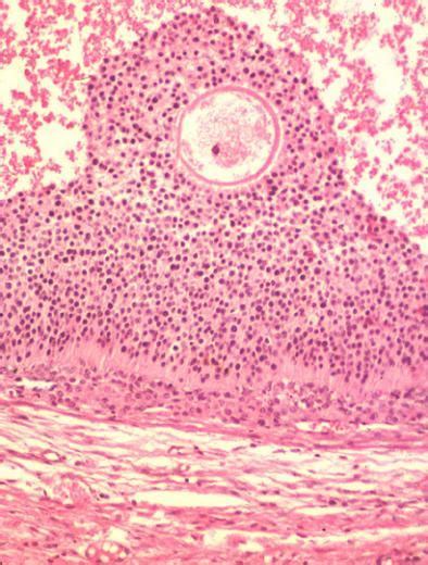 Cumulus oophorus in a secondary follicle. – Collection of Histology Images