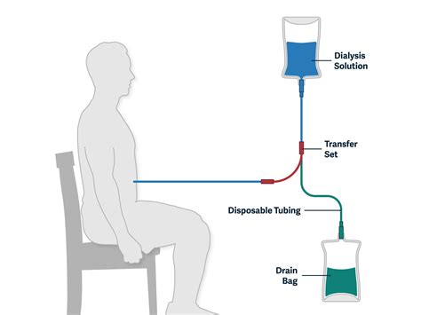 Peritoneal Dialysis Ati Template