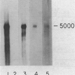 Southern blotting analysis of human genomic DNA digested with Eco RI ...