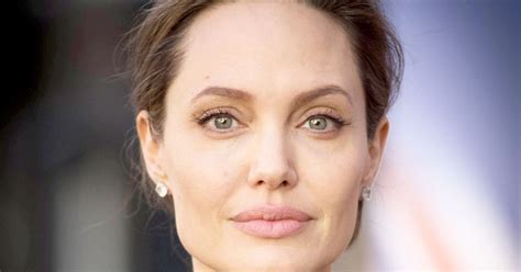 Angelina Jolie Bells Palsy Acupuncture, Face Droop VF