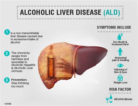 Alchoholic Liver Diseases: Symptoms and Best Treatment - AILBS