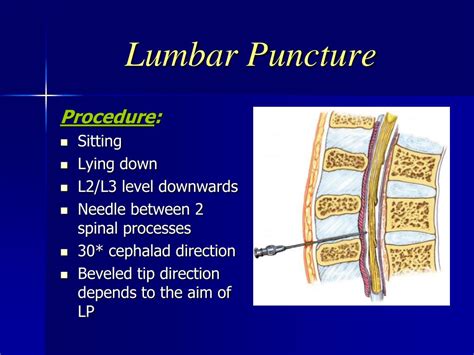 PPT - Lumbar Puncture PowerPoint Presentation, free download - ID:3060338