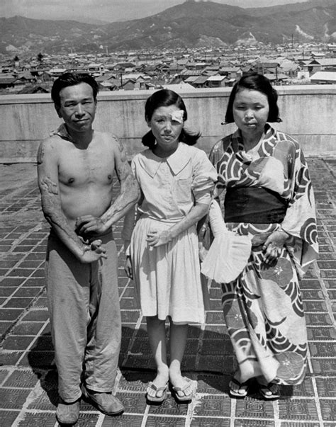 Hiroshima: Photos of Survivors of the World's First Atomic Attack