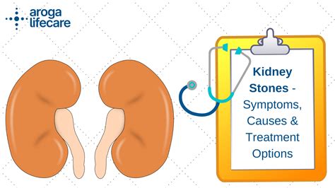 causes of kidney stones - causes of kidney stonescauses of kidney stones