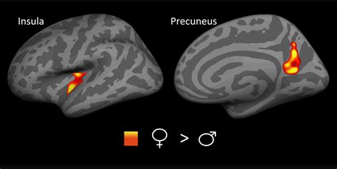 The science of migraines | Science | AAAS