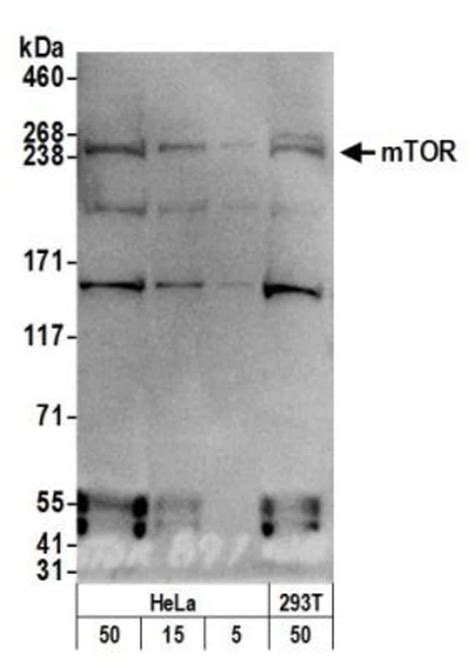 TOR/MTOR - 0.1 ML