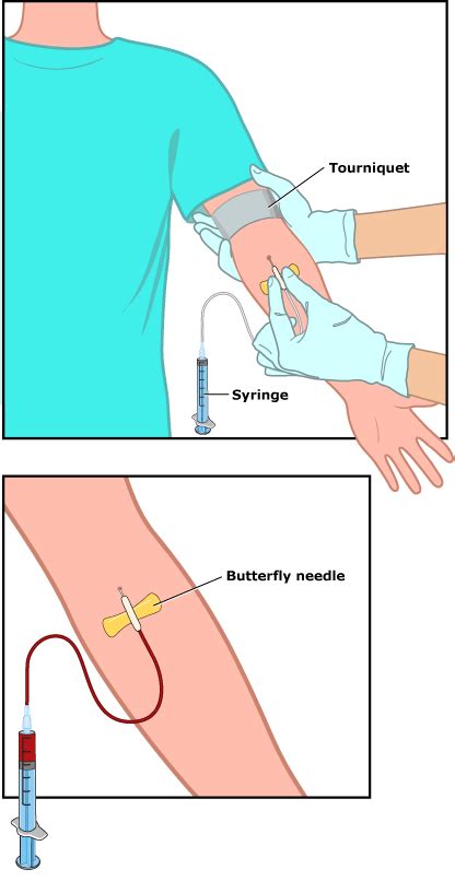 Getting a Blood Test (for Teens) - East Tenneesee Children's