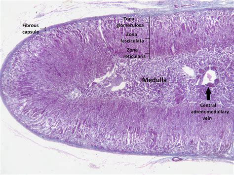 Addison Disease Histology