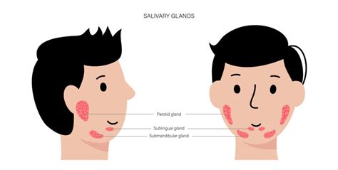 Salivary Gland Disorders | Causes & Symptoms | Birla Hospital