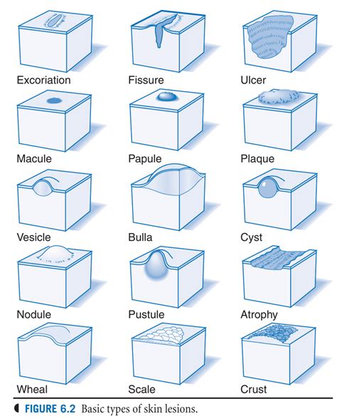 Benign Skin Lesions