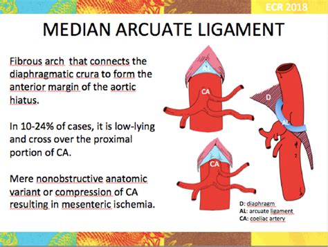 Figure 7 from Complications of vascular impingement in the median arcuate ligament syndrome ...