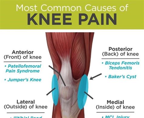 Knee Pain: Common causes of knee pain