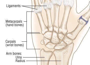 Wrist Sprain Guide: Causes, Symptoms and Treatment Options