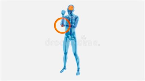 Anatomy Concept of an Elbow Pain Stock Illustration - Illustration of ...