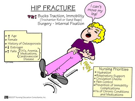 Hip Fractures - Fracture Treatment