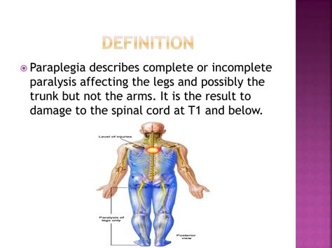 Paraplegia Causes