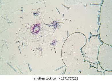 Microbes Under Microscope Stock Photo 1271767282 | Shutterstock