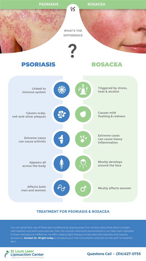 Psoriasis vs Rosacea – What’s the Difference | St Louis Lipo