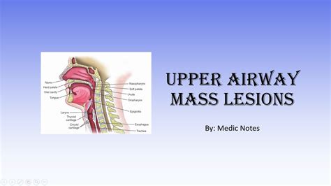 Upper airway lesions - Hemangioma, laryngeal web, laryngeal cyst ...